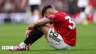 Benjamin Sesko injury: Manchester United play down severity of striker’s injury